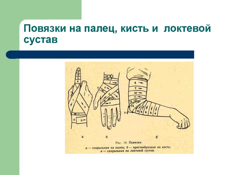 Повязки на палец, кисть и  локтевой сустав